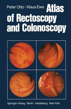 Atlas of Rectoscopy and Colonoscopy - Otto Peter uKlaus Ewe