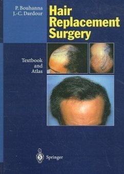 Hair Replacement Surgery - Bouhanna, Pierre; Dardour, Jean-Claude