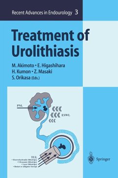 Treatment of Urolithiasis - Akimoto, Masao / Higashihara, Eiji / Kumon, Hiromi / Masaki, Zenjiro / Orikasa, Seiichi (eds.)