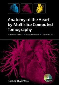 Anatomy of the Heart by Multislice Computed Tomography - Faletra, Francesco;Pandian, Natesa;Ho, Siew Yen