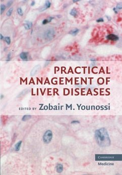 Practical Management of Liver Diseases