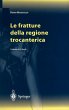 Le Fratture Della Regione Trocanterica - Bild 1