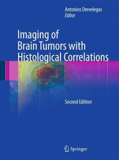 Imaging of Brain Tumors with Histological Correlations - Drevelegas, Antonios (ed.)