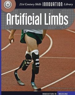 Artificial Limbs - Gray, Susan H