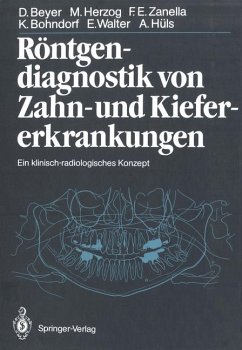 Röntgendiagnostik von Zahnerkrankungen und Kiefererkrankungen - Beyer, D., M. Herzog F. E. Zanella u. a.