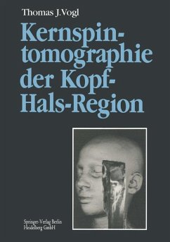 Kernspintomographie der Kopf-Hals-Region. Funktionelle Topographie - klinische Befunde - Bildgebung - Spektroskopie.