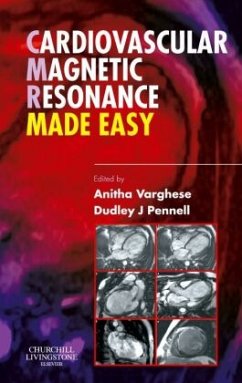 Cardiovascular Magnetic Resonance Made Easy - Varghese, Anitha;Pennell, Dudley J.