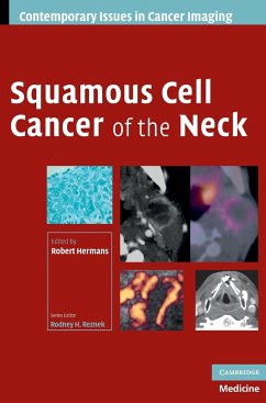 Squamous Cell Cancer of the Neck