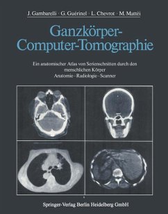 Ganzkörper-Computer-Tomographie: Ein anatomischer Atlas von Serienschnitten durch den menschlichen Körper Anatomie _ Radiologie _ Scanner