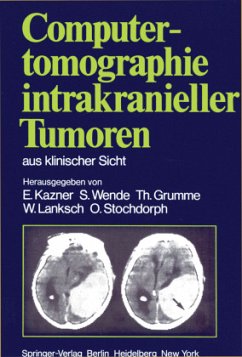 Computertomographie intrakranieller Tumoren aus klinischer Sicht