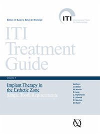 Implant Therapy in the Esthetic Zone - Hämmerle, Christoph; Jung, Ronald; Martin, William C.; Morton, Dean; Schmid, Bruno