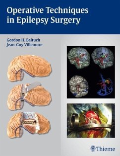 Operative Techniques in Epilepsy Surgery - Baltuch, Gordon H.;Villemure, Jean-Guy