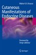 Cutaneous Manifestations of Endocrine... - Bild 1