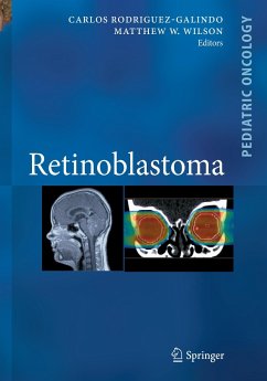 Retinoblastoma - Rodriguez-Galindo, Carlos / Wilson, Matthew W. (Hrsg.)