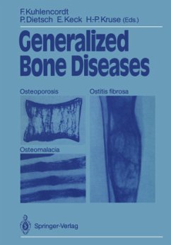 Generalized Bone Diseases