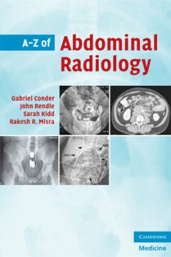 A-Z of Abdominal Radiology - Conder, Gabriel; Rendle, John; Kidd, Sarah; Misra, Rakesh R