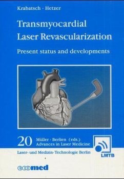 Transmyocardial Laser Revascularization