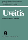Uveitis Uveitis