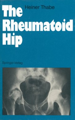 The Rheumatoid Hip
