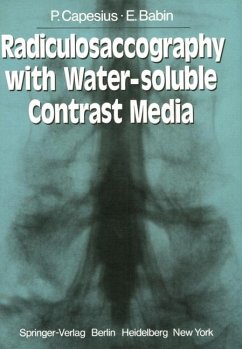 Radiculosaccography with Water-soluble Contrast Media