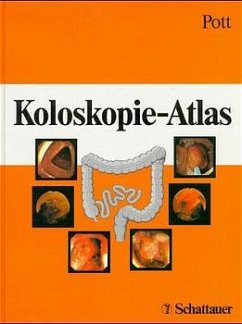 Koloskopie-Atlas