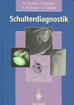 Schulterdiagnostik