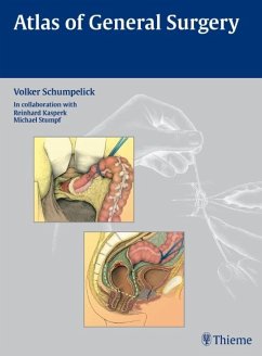 Atlas of General Surgery - Schumpelick, Volker