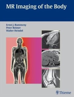 Whole Body MR Imaging - Heindel, Walter;Reimer, Peter;Rummeny, Ernst J.