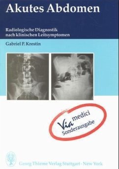 Akutes Abdomen, Sonderausgabe - Krestin, Gabriel P.