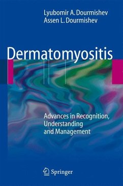 Dermatomyositis - Dourmishev, Lyubomir A.;Dourmishev, Assen Lyubenov