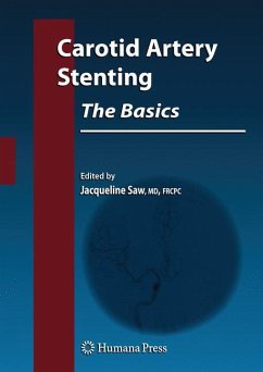 Carotid Artery Stenting: The Basics - Saw, Jacqueline (ed.)