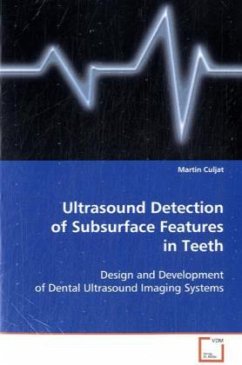 Cover Ultrasound Detection of Subsurface Features in Teeth