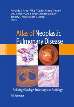 Atlas of Neoplastic Pulmonary Disease - Fraire, Armando E. / Cagle, Philip T. / Irwin, Richard S. / Mody, Dina R. / Ernst, Armin / Blackmon, Shanda / Allen, Timothy C. / Dishop, Megan K. (ed.)