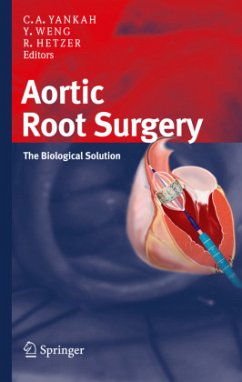 Aortic Root Surgery - Yankah, Abraham Charles / Weng, Yu-Guo / Hetzer, Roland (ed.)