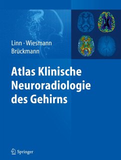 Atlas Klinische Neuroradiologie des Gehirns - Linn, Jennifer;Wiesmann, Martin;Brückmann, Hartmut