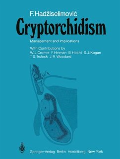 Cryptorchidism : management and implications. With contributions by W. J. Cromie ... Foreword by F. Hinman