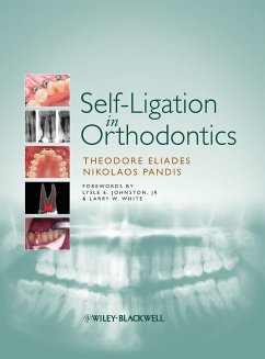 Self-Ligation in Orthodontics - Eliades, Theodore; Pandis, Nikolaos