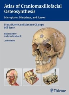 Atlas of Craniomaxillofacial Osteosynthesis - Härle, Franz;Champy, Maxime;Terry, Bill C.