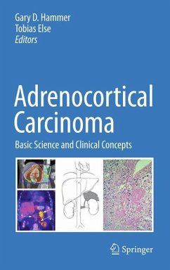 Adrenocortical Carcinoma - Hammer, Gary D. (ed.)