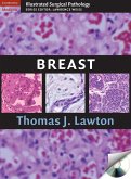 Illustrated Surgical Pathology of the Breast