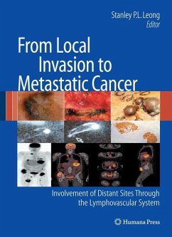 From Local Invasion to Metastatic Cancer - Leong, Stanley P.L. (ed.)