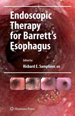 Endoscopic Therapy for Barrett's Esophagus - Sampliner, Richard E. (ed.)