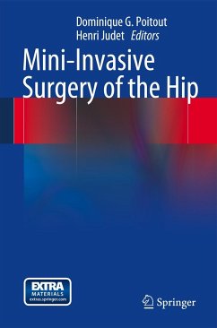 Mini-Invasive Surgery of the Hip - Poitout, Dominique G. / Judet, Henri (Hrsg.)