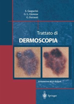 Trattato Di Dermoscopia - Gasparini, Saturnino;Giovene, Gian Luigi;Ferranti, Giulio