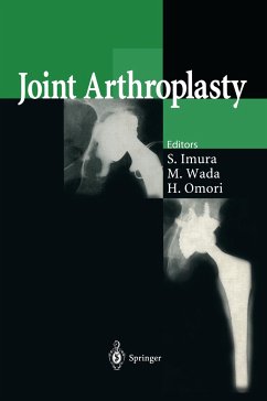 Joint Arthroplasty