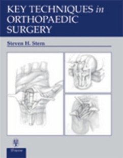 Key Techniques in Orthopaedic Surgery - Stern, Steven H.