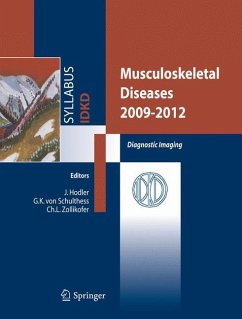 Musculoskeletal Diseases 2009-2012 - Hodler, Jürg / Schulthess, Gustav K. von / Zollikofer, Christoph L. (ed.)