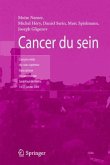 Cancer du sein