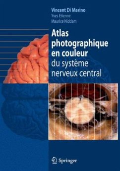 Atlas photographique en couleur du système nerveux central - Di Marino, Vincent