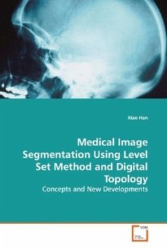 Medical Image Segmentation Using Level Set Method and Digital Topology - Han, Xiao